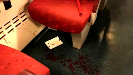 Follia in treno: calci e pugni, poi stacca un pezzo di dito a morsi al passeggero