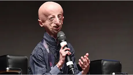 Malore al ristorante: è morto Sammy Basso, il malato di progeria più longevo al mondo